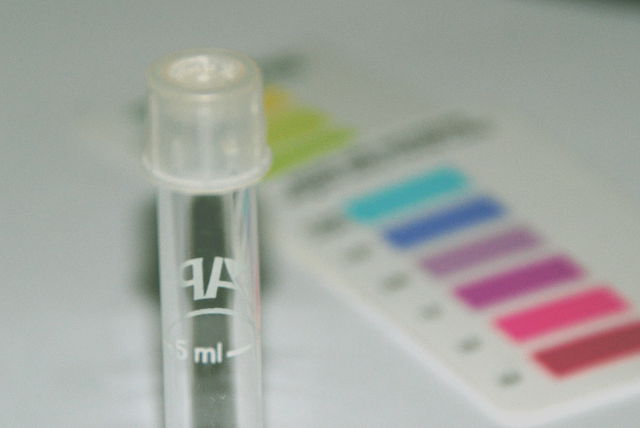 Koi pond water quality test